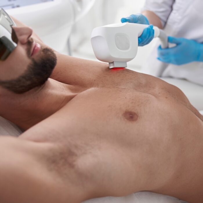 Beautician removes hair from are chest of sportive man at photoepilation procedure in clinic